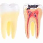 Bondi Dental | Dental Abscess | Dentist Bondi
