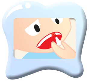 Bondi Dental | Knocked Out Tooth | Dentist Bondi