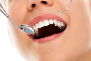 Bondi Dental | Tooth Fillings | Dentist Bondi