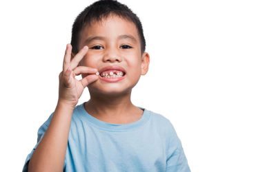 Knocked Out Tooth in Children: What to Do in a Dental Emergency