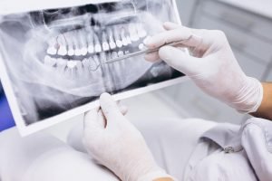 dental x-rays bondi