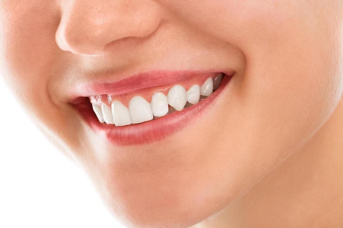Porcelain Fillings Bondi Bondi Dental Dentist Bondi