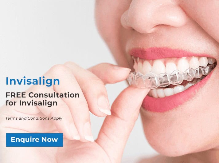 invisalign promo banner bondi