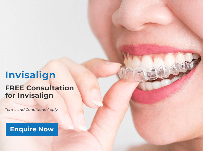 Invisalign Tips & Tricks at Bondi Dental